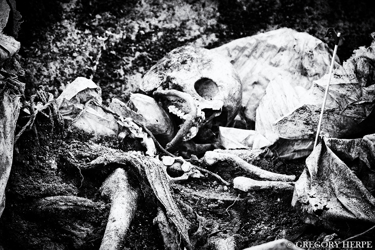 Gregory Herpe photo of a mass grave in Nagorno-Karaback. Edilli.